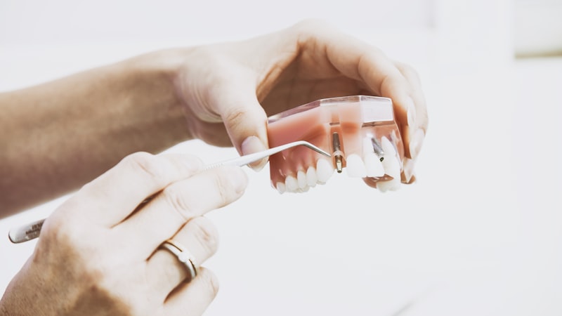 Brossage des dents : technique, outils et duree ideale