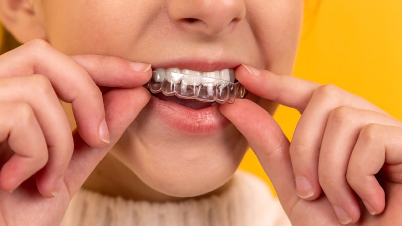 Peri-implantite : comprendre et prevenir les lesions